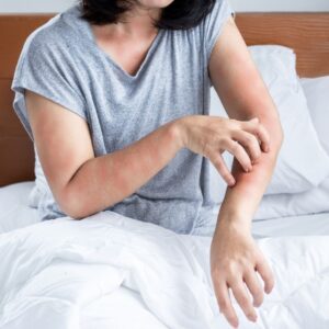 rash on arm