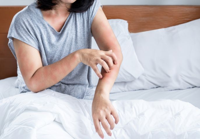 Bed-Bugs-Arlington-1.jpg